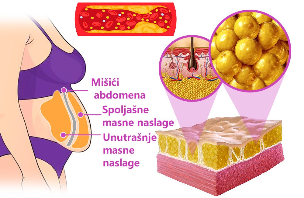 Flasteri za mršavljenje 5 komada