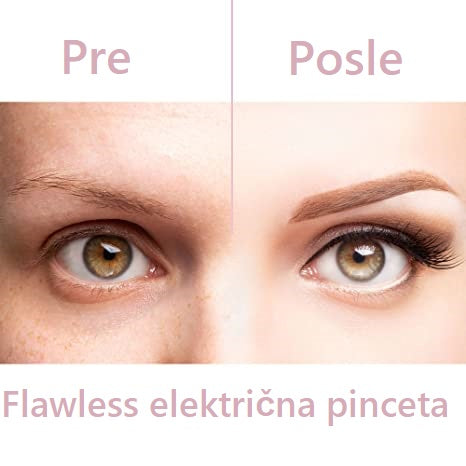 Flawless električna pinceta